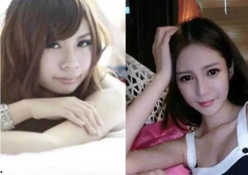 为网红整容像ab  第2张