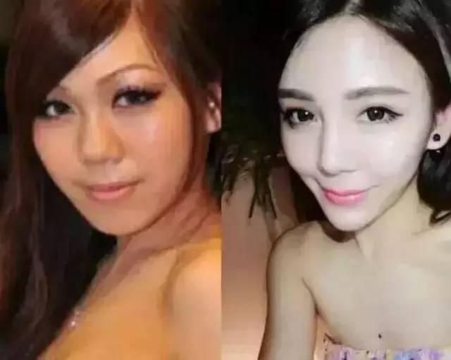 为网红整容像ab  第3张