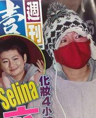 she里的s烧伤照片  第2张